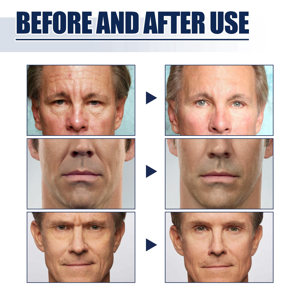 East Moon Men’s Face Firming Kit | Reduce Fine Lines & Wrinkles | Lift, Tighten & Brighten Skin